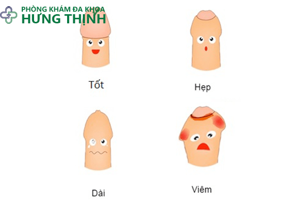 Chữa viêm bao quy đầu ở trẻ em