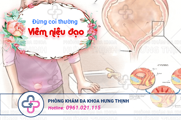 Viêm niệu đạo nữ có nguy hiểm không?